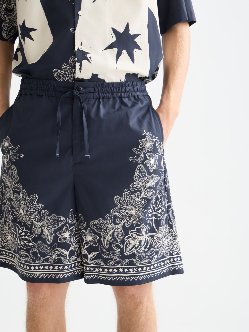 Printed wide bermuda shorts