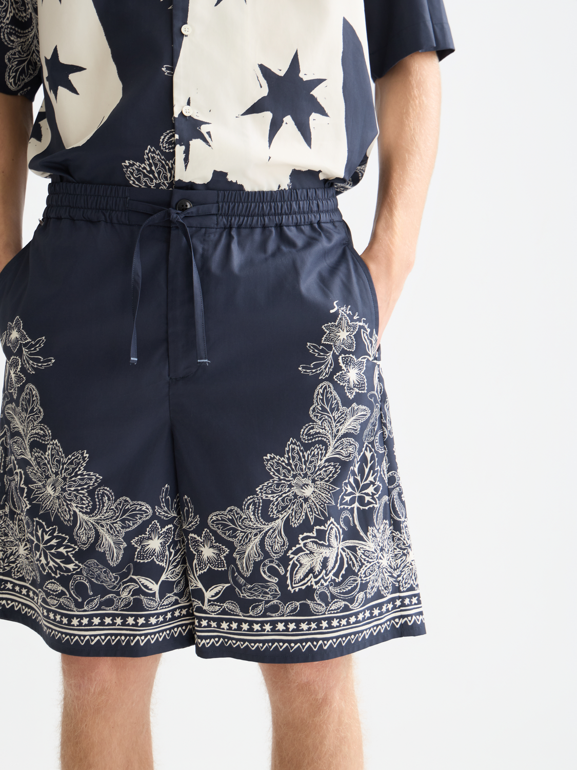 Printed wide bermuda shorts